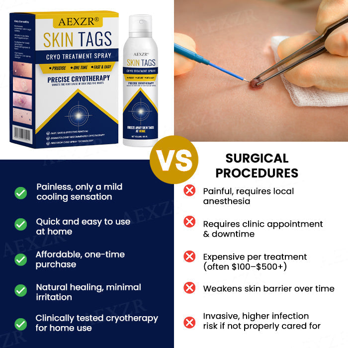 ❄️ Fast-Acting Cryo Formula! | ✨ Freeze Blemishes Instantly! | AEXZR® Skin Tag Cryo Treatment Spray