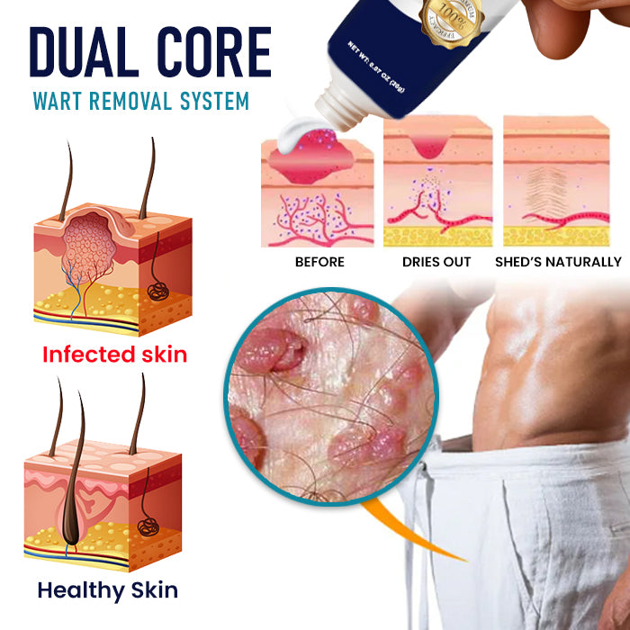 🌟 Official Store | 🛡️ Painless Removal in Just 3 Days! Clinical-Grade Sensitive Formula. RZXEA™ Genital Warts Remover Cream.