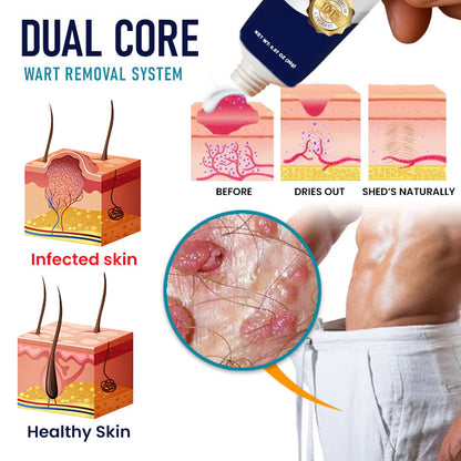 🌟 Official Store | 🛡️ Painless Removal in Just 3 Days! Clinical-Grade Sensitive Formula. RZXEA™ Genital Warts Remover Cream.
