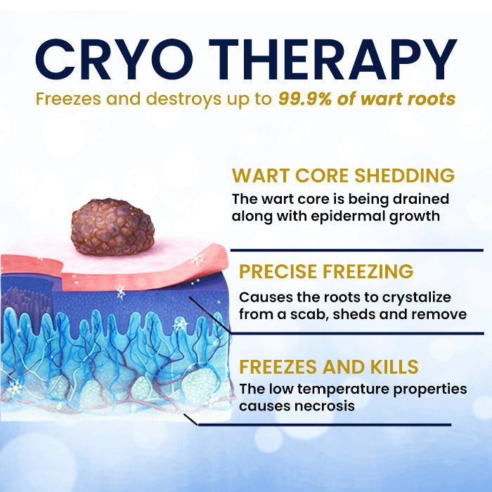 ❄️ Fast-Acting Cryo Formula! | ✨ Freeze Blemishes Instantly! | AEXZR® Skin Tag Cryo Treatment Spray