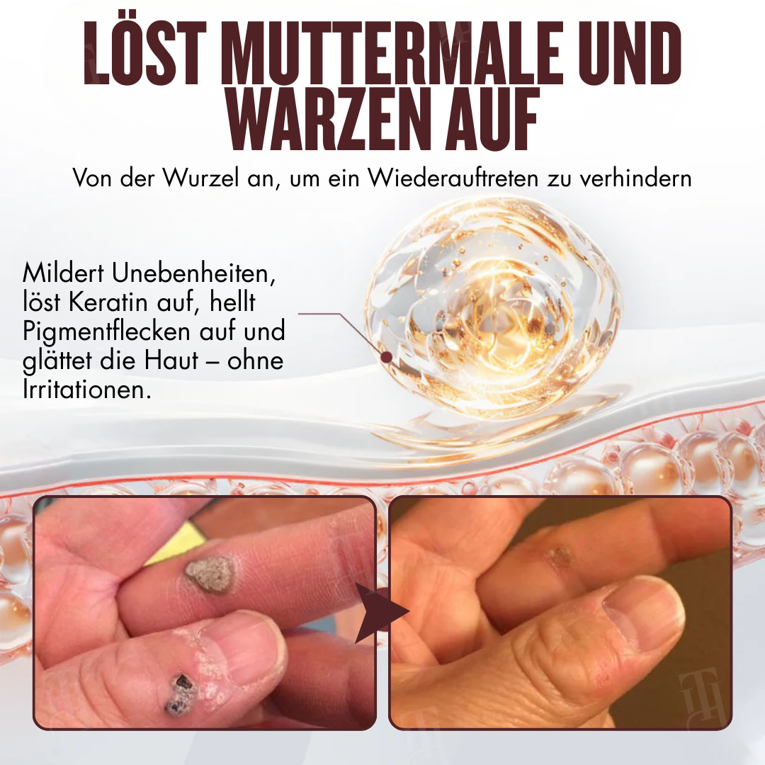 🏆Offizieller Store | 🛡️ Schluss mit brennenden Säuren! Entfernen Sie Hautmakel sanft & sicher RZXEA™ All-in-1 Ceramide Hautcreme
