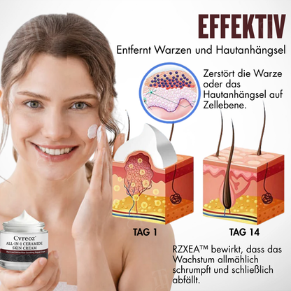 🏆Offizieller Store | 🛡️ Schluss mit brennenden Säuren! Entfernen Sie Hautmakel sanft & sicher RZXEA™ All-in-1 Ceramide Hautcreme