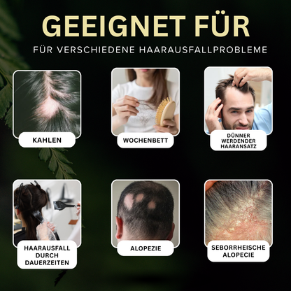 🌟 Tienda oficial | 🛡️ Detén la caída del cabello de raíz. ¡Pelo más denso en 20 días! | Champú Revitalizante Bio-Signal con Exosomas AEXZR®