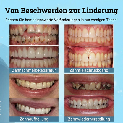 🌟Offizieller Store | 🛡️ Lockere Zähne festigen & Zahnfleischrückgang natürlich umkehren!AEXZR® Nicht-chirurgisches Zahnfleisch- "Naht“-Gel